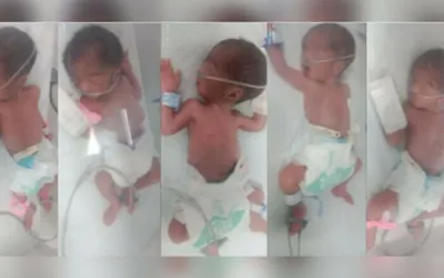 Quintuplets born to Karachi resident through emergency