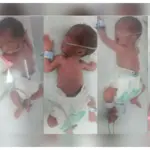 Quintuplets born to Karachi resident through emergency