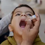 New polio case detected in KP