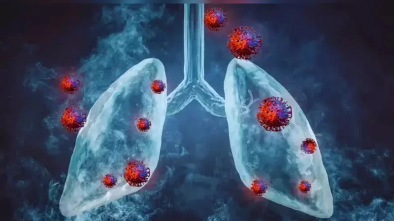 HMPV cases being circulated in Pakistan for two decades: NIH
