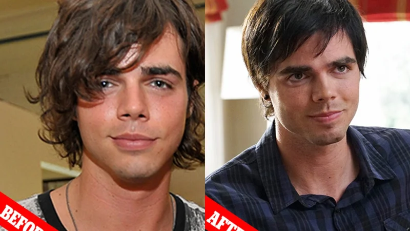 When Dylan Reid Ewing revealed his struggles with plastic surgery to look like Brad Pitt