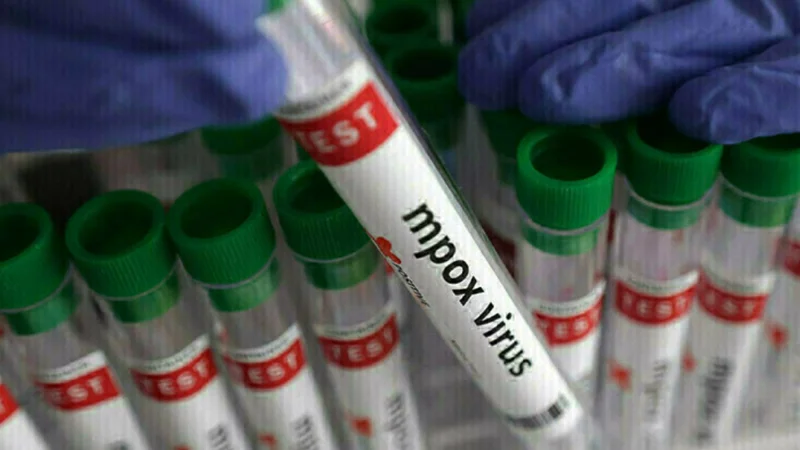 Another Mpox case detected in Khyber Pakhtunkhwa