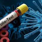 Concerns rise as three polio samples test positive