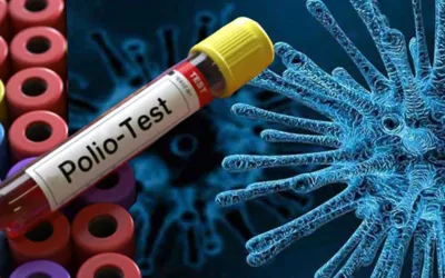 Polio virus detected in sewage of 14 districts across Pakistan