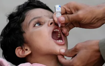 Raises concern over rising polio cases in Sindh