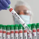 WHO confirms first human fatality from H5N2 Bird flu