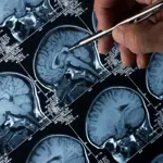 New AI tool detects brain tumors in minutes instead of days
