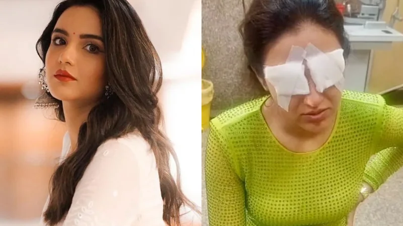 Jasmin Bhasin Faces Severe Corneal Damage from Contact Lens Mishap