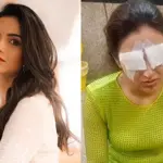 Jasmin Bhasin Faces Severe Corneal Damage from Contact Lens Mishap