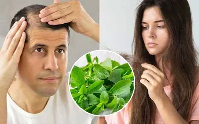 Stevia patch offers new hope for hair loss