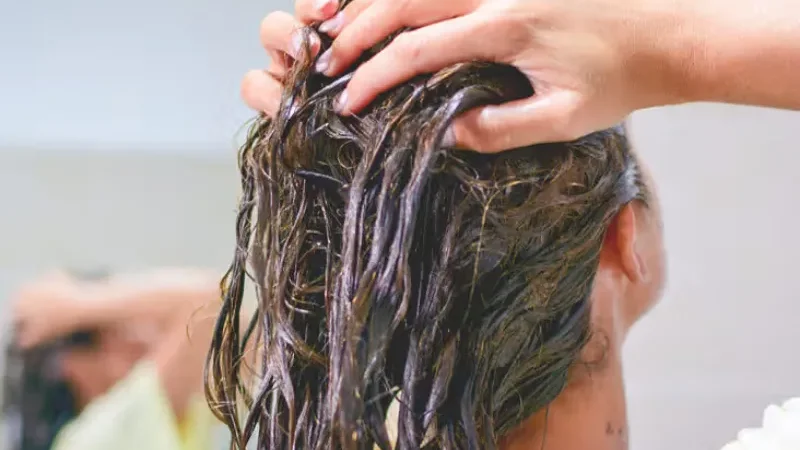 Simple home remedy for itchy scalp and dandruff - dandruff, home remedy, itchy scalp, mustard oil