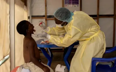WHO official dismisses Mpox as new COVID variant