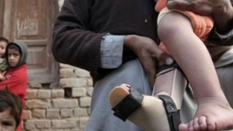 Another polio case reported in Karachi