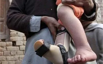 Another polio case surface in Pakistan