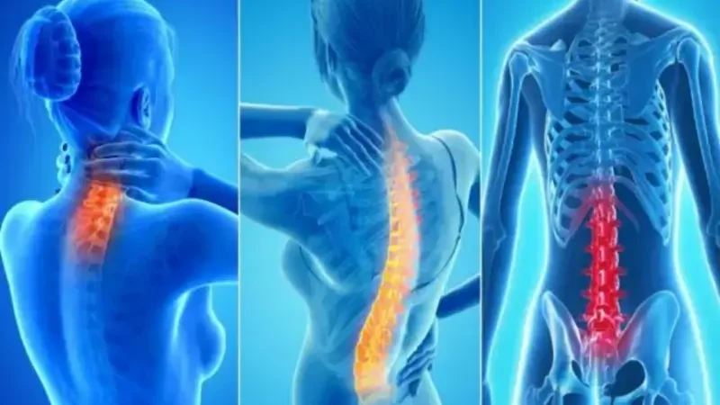 Three easy exercises to help reduce back pain