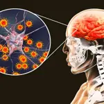 Encephalitis survivors face hidden mental health struggles