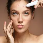 6 common medications that can trigger ‘Acne’ breakouts, experts say