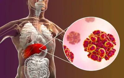 Here's all you need to know about Hepatitis