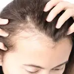 Five tips to care for thinning hair