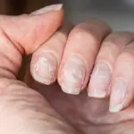 Signs of unhealthy nails you shouldn’t ignore