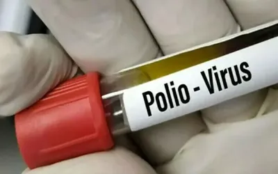 Two new polio cases confirmed in Khyber Pakhtunkhwa