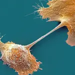 New drug shows promising results against Pancreatic Cancer