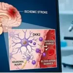 Scientists expose brain-destroying protein