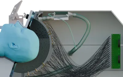 British scientists develop ultrasound helmet for Non-Surgical brain treatment