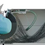 British scientists develop ultrasound helmet for Non-Surgical brain treatment