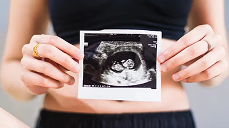 Ultrasound