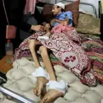 Gaza: Hunger kills 289, 15,000 awaits for medical evacuation