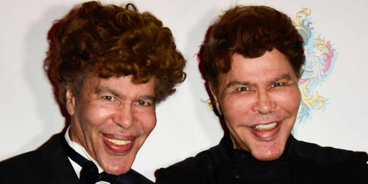 Eccentric French TV twins die of Covid after refusing jab